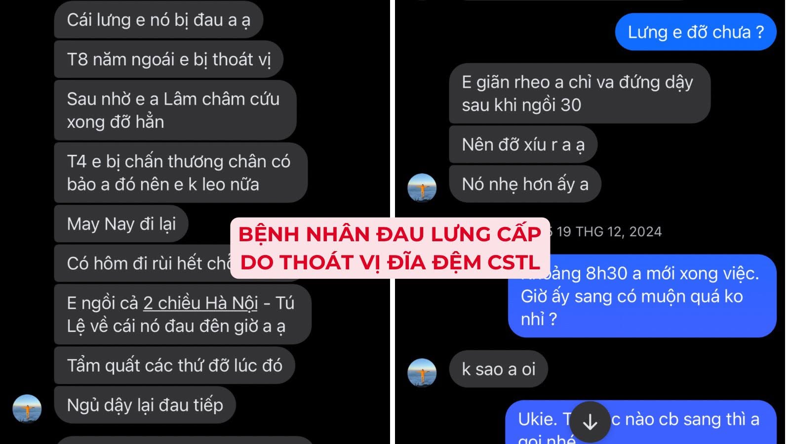 Tin nhắn Zalo bệnh nhân đau lưng cấp do thoát vị đĩa đệm cột sống thắt lưng